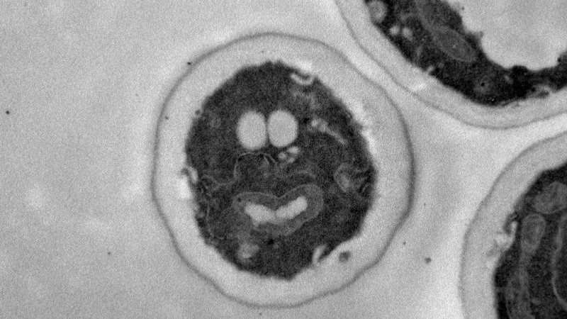 Mikrobe des Jahres 2022  ist die Bäckerhefe Saccharomyces cerevisiae